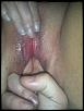 2 fingers