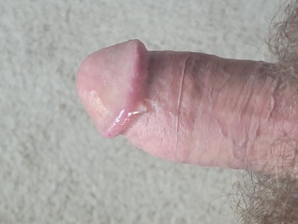 My Penis